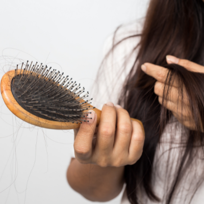Naturopathic treatments for Hair Loss